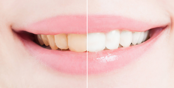 Liora Dental - Dr Seema Satish